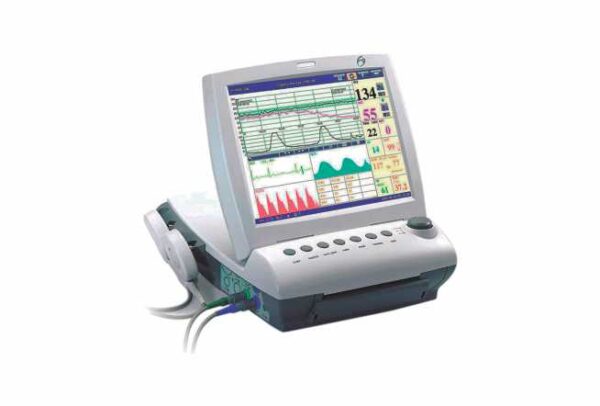 MONITOR FETAL